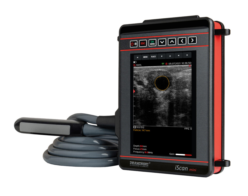 PREGNANCY SCANNER – ISCAN MINI