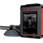 PREGNANCY SCANNER – ISCAN MINI - Image 1